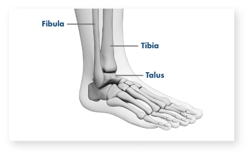 Ankle Pain – Common Causes and Symptoms | Stryker