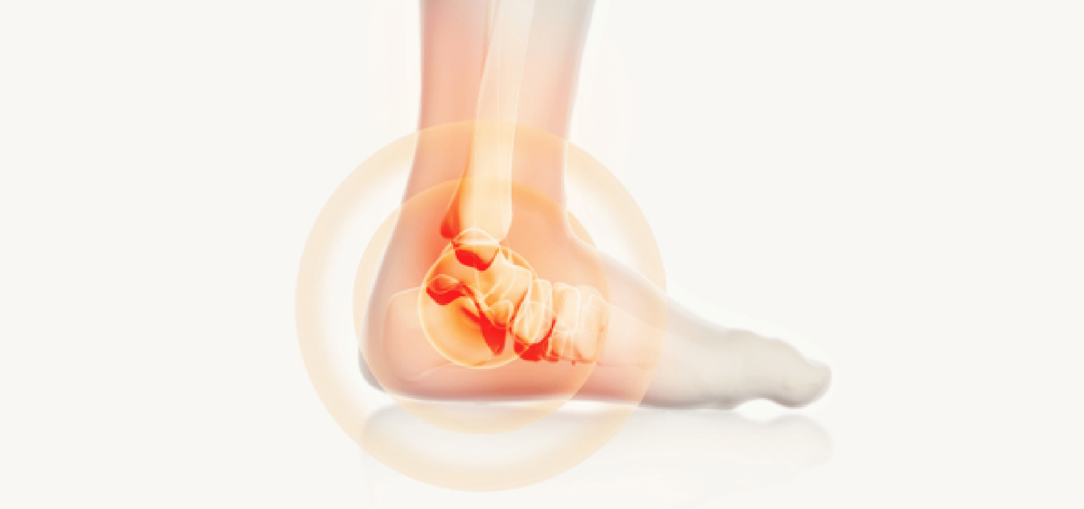 Ankle Replacement — Ankle Arthritis