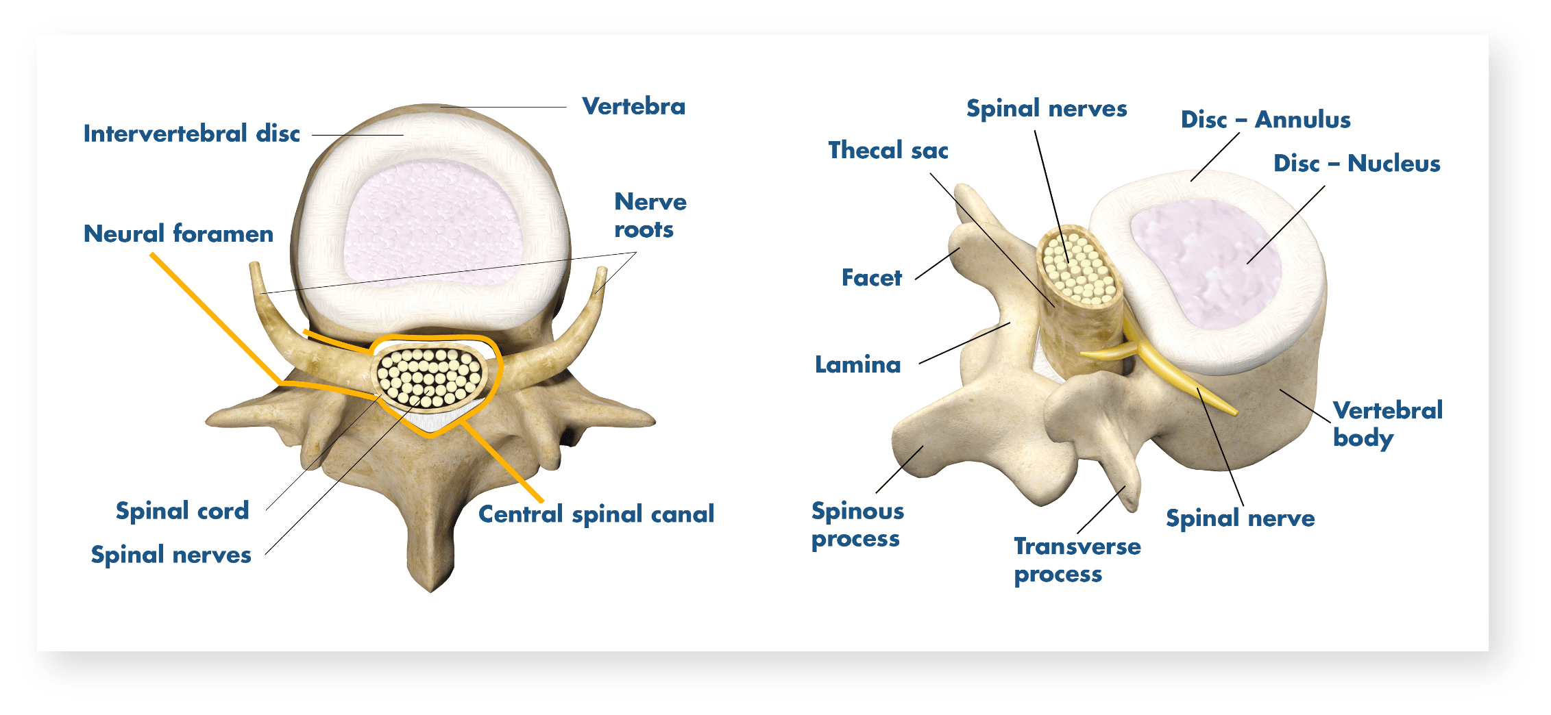 what-does-scoliosis-pain-feel-like-scoliosis-treatment-with-dr-tony