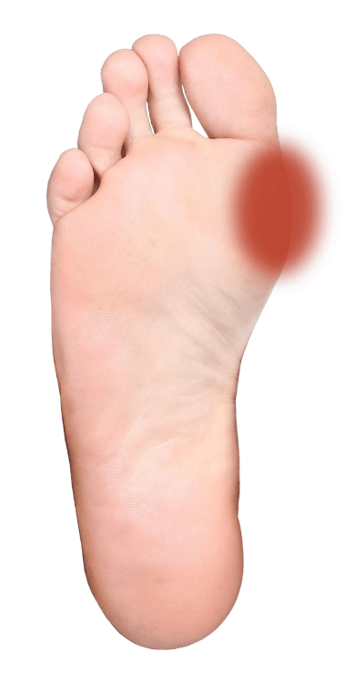 Treating Your Foot Pain Stryker