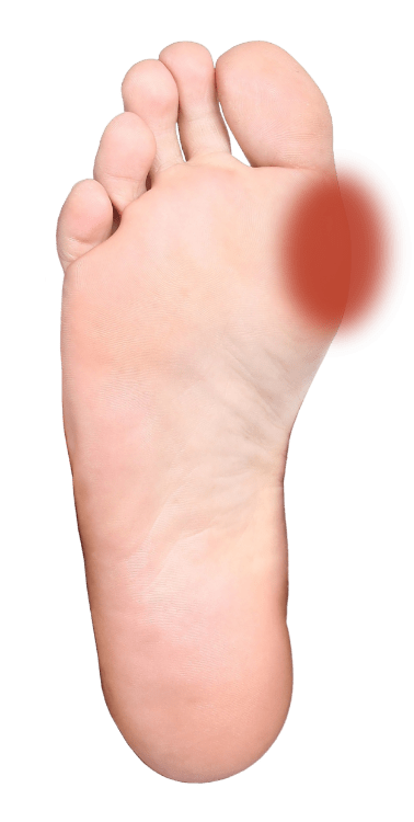 Pain in soles hot sale of both feet