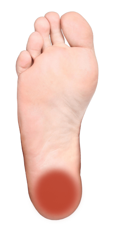 foot-pain-common-causes-and-symptoms-stryker