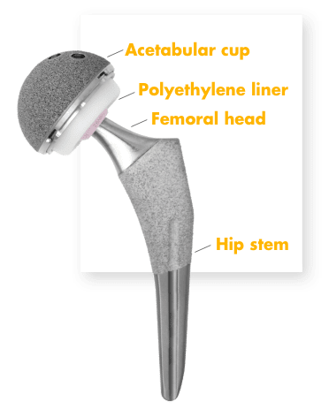 Hip stem image