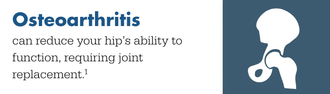 Osteoarthritis can reduce your hip's ability to function, requiring hip replacement surgery 