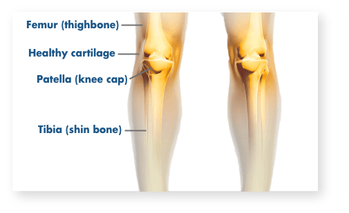 Femur, Healthy Cartilage, Patella, Tibia