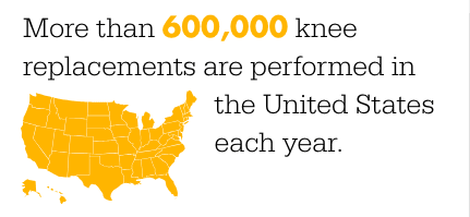 More than 600,000 knee replacements are performed in the United States each year 
