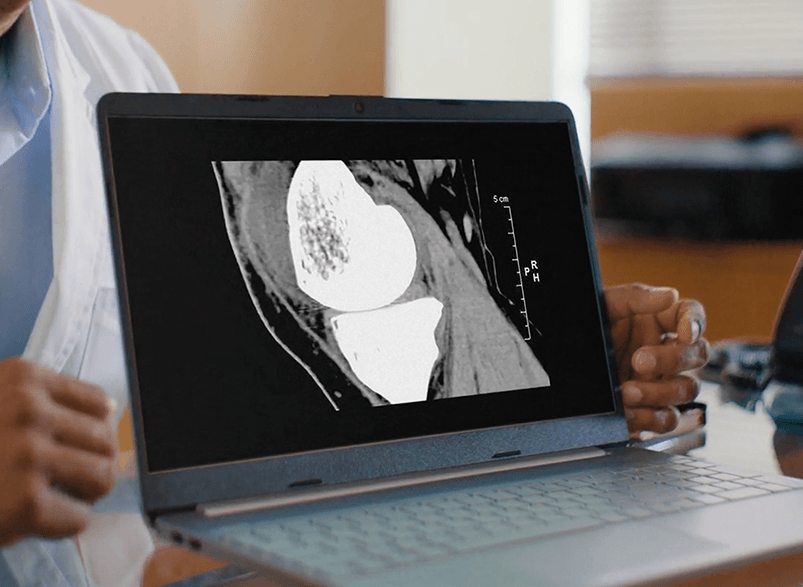 Doctor looking at a knee CT scan on a computer.