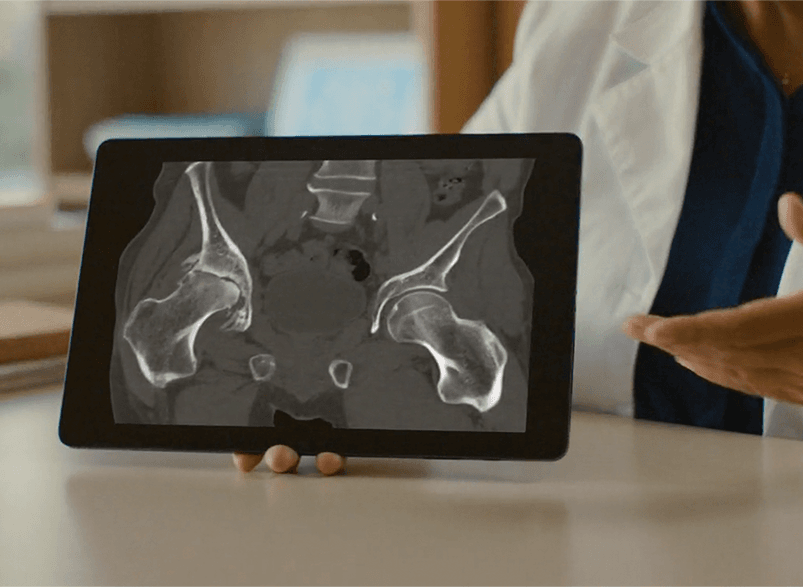 hip scan