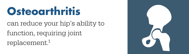 Osteoarthritis can reduce your hip's ability to function, requiring hip replacement surgery